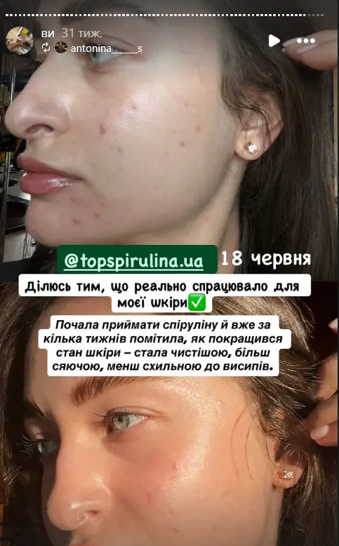 stories